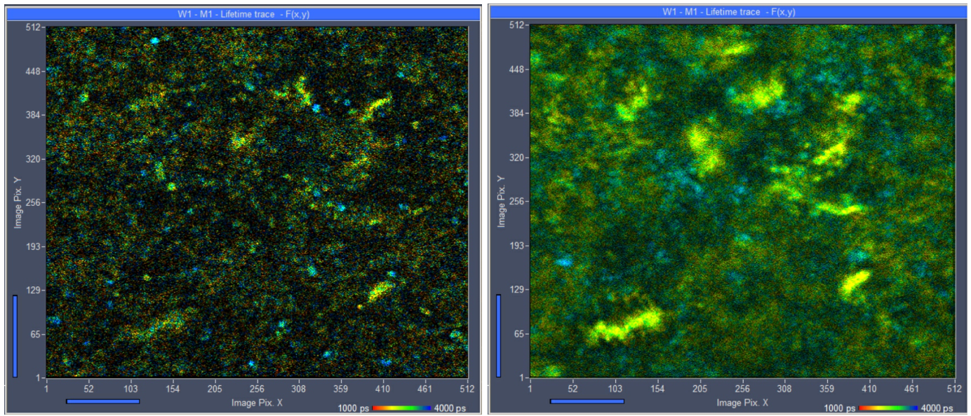 移动细菌的无标签多光子FLIM插图1 移动细菌的无标签多光子FLIM插图1
