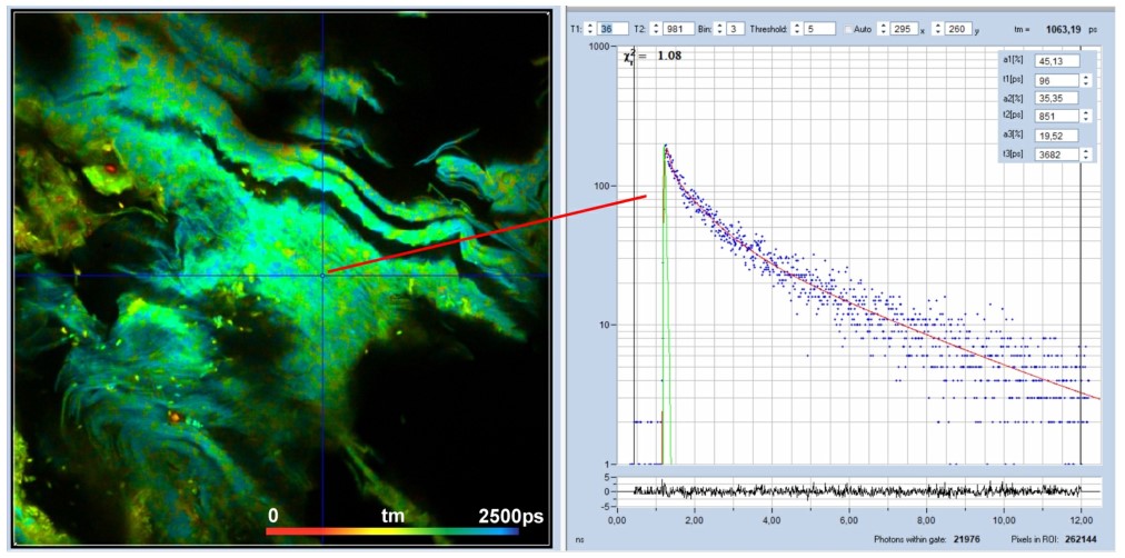 恶性黑色素瘤的超快荧光寿命衰减插图2 恶性黑色素瘤的超快荧光寿命衰减插图2