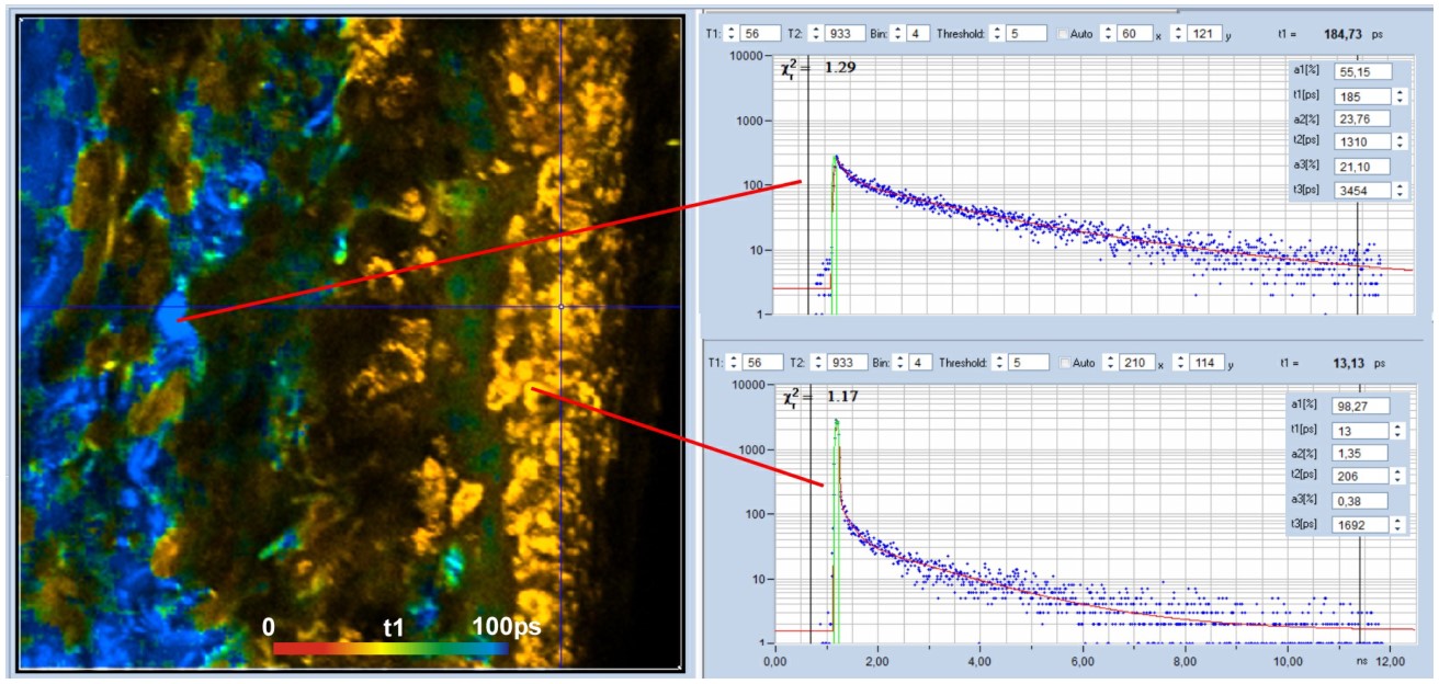 恶性黑色素瘤的超快荧光寿命衰减插图1 恶性黑色素瘤的超快荧光寿命衰减插图1